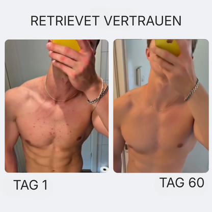 Reinigende Anti-Akne-Seife Nach Dem Sport